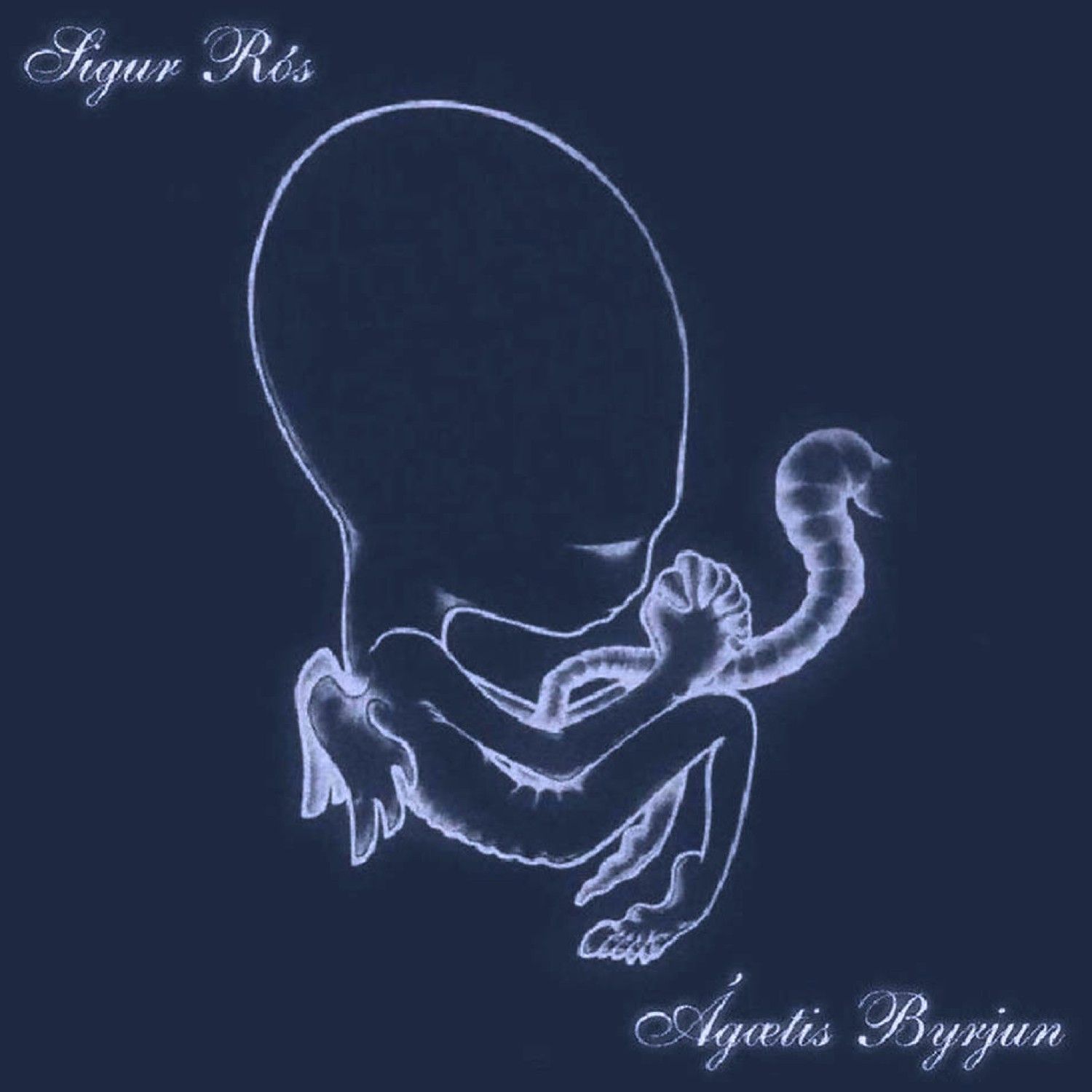 Agaetis Byrjum